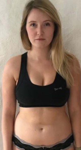 before Hormify usage